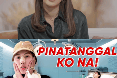 Alex Gonzaga, Ibinunyag ang Naging Dahilan sa Pagpapatanggal ng Kanyang Rhinoplasty Matapos ang Dalawang Taon!