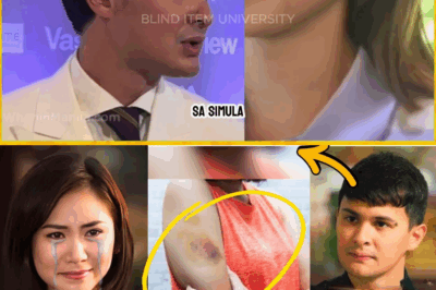 ANG BAKAS NG SAKIT: Sarah Geronimo, Nag-Iyak at Nag-Amin ng Mga Pasa sa Braso at Pang-Aabuso sa Piling ni Matteo Guidicelli